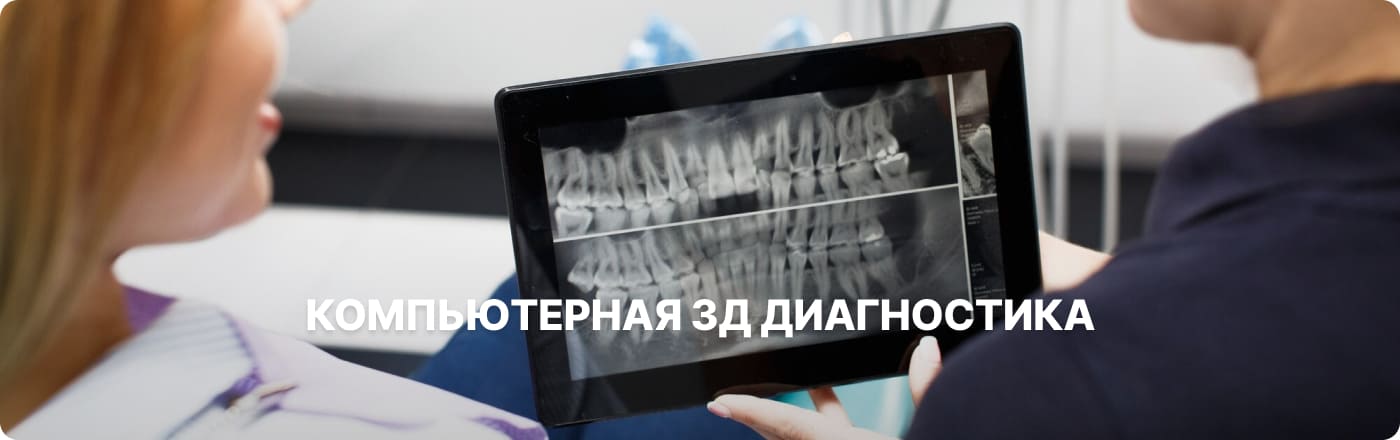 Компьютерная томография