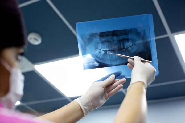 панорамний рентген зубів